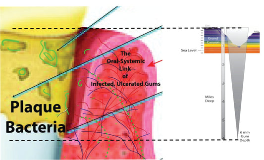 The Evils of Gum Disease